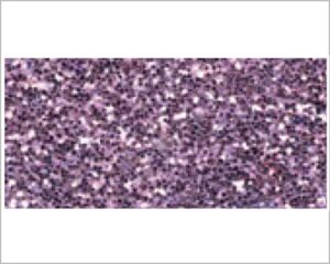 GLITTER ROSA GR. 7